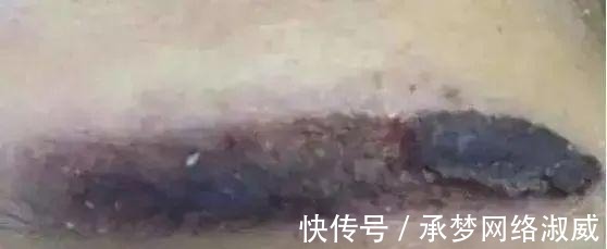 医生|为什么医生不提倡女生纹眉?内行人道出其中缘由,幸好没跟风