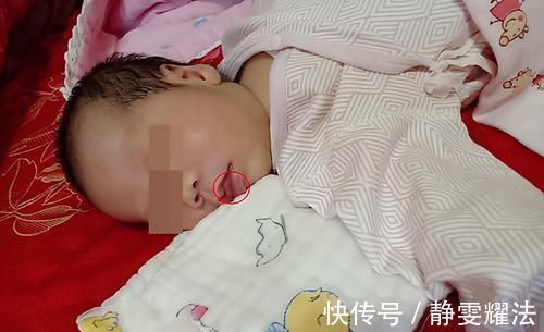 消化器官|五个月女婴双肾长满结石,只因刚出生三天,父母就开始做这件事