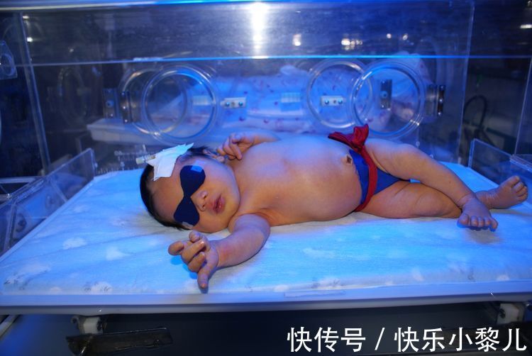 新生儿|孕期最好少吃这三种食物,它们是新生儿黄疸的温床,对孕妇也不利