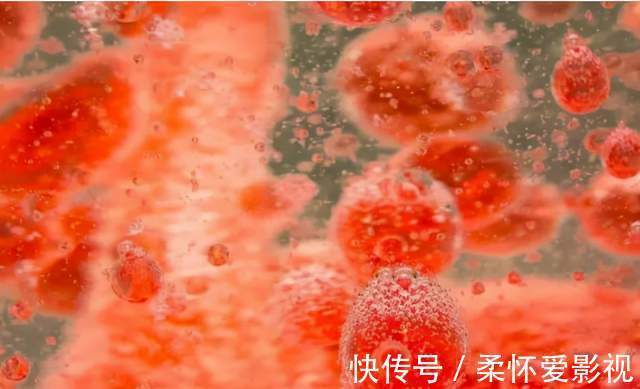 胆固醇|血脂高不高,全写在脸上!脸上出现5个“表现”,请及时调理