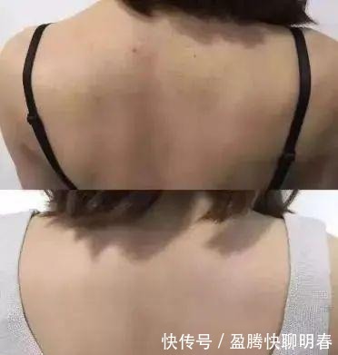 薇娅|能让李佳琦和薇娅看得上,这韩国去角质凝胶,实力真的很强大