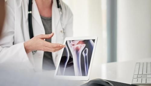 钙质|骨质疏松的“发物”是花生?医生:若想养骨,少吃这“2绿”!