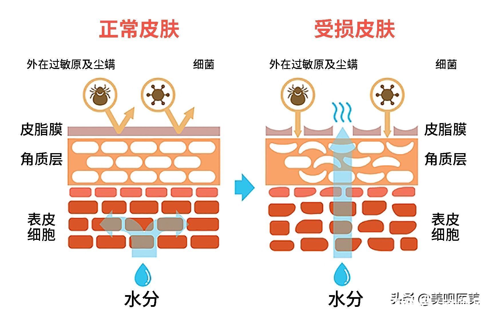 皮脂|揭秘护肤谎言！关于皮肤的10个真相，你需要了解