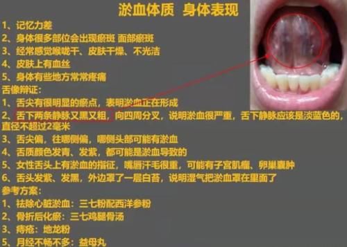 失眠多梦|九种体质辩证：气虚、血虚、瘀血、阳虚、痰湿、阴虚，值得收藏