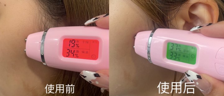 精准|功能型面膜VS补水面膜，精准和精简之间你选对了吗