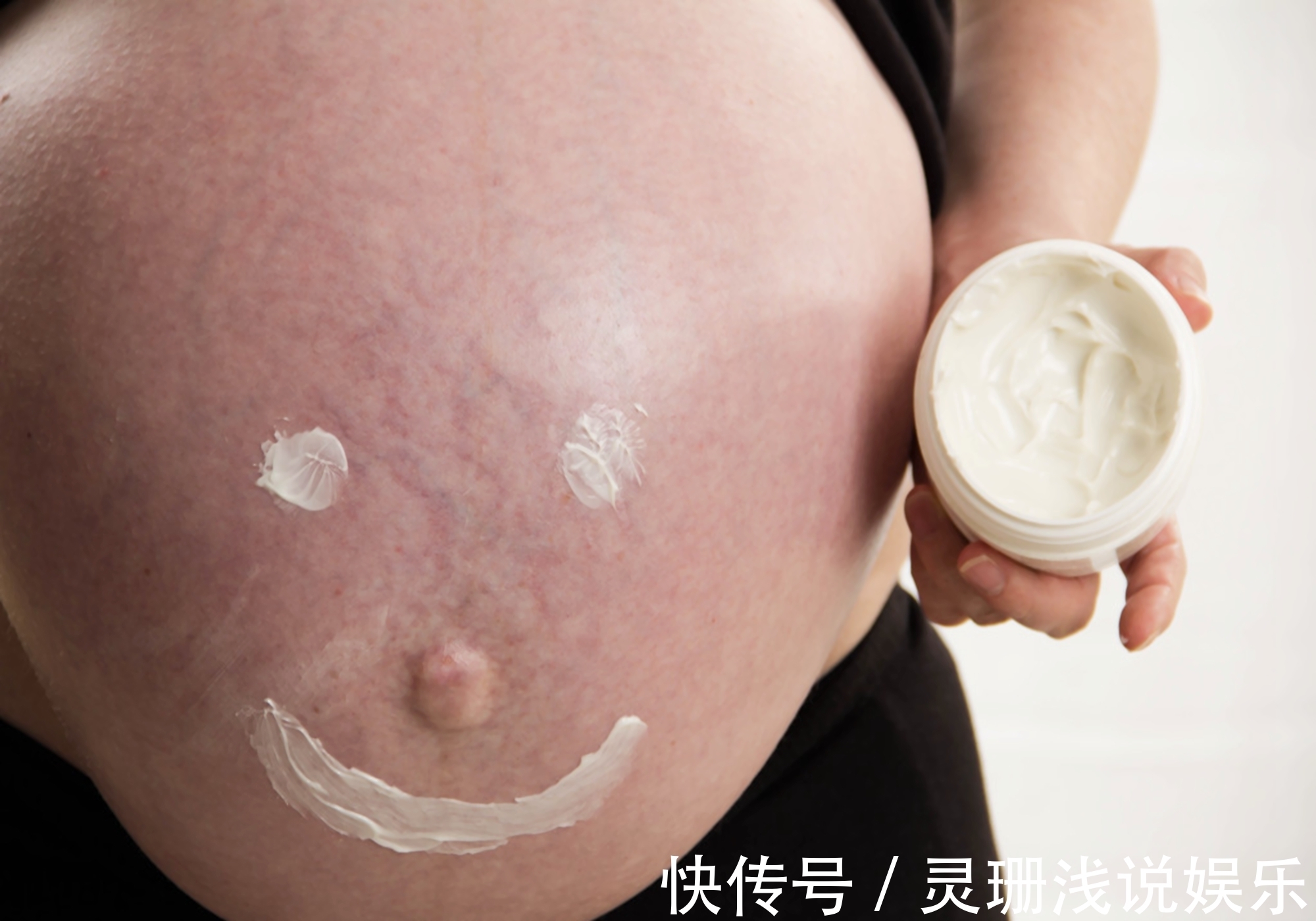 妊娠纹|孕期妊娠纹也挑人,4类孕妈躲得开,如果你全都符合,真让人羡慕