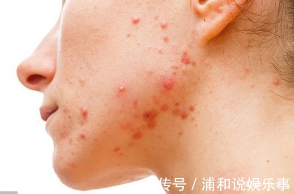 皮肤病|小小一粒“豆”,内服治脚气水肿,外敷搞定痤疮,等十几种皮肤病