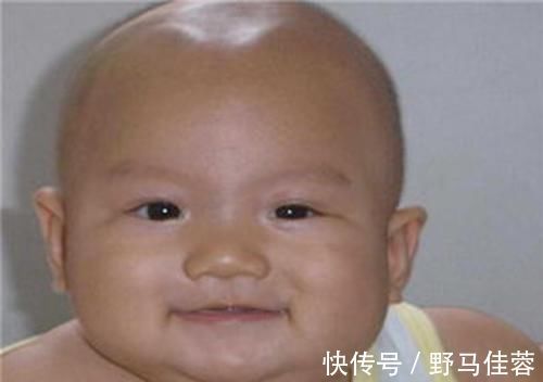 前囟门|囟门被称为宝宝的“命门”,若出现这几种形态,别耽搁赶紧去医院