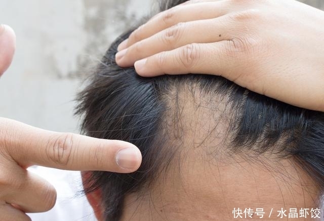 皮肤瘙痒|肝脏受伤的6个表现,不好好休养,肝炎说来就来!