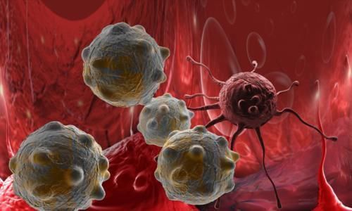 胸腔积液|肺癌最可怕的不是疾病本身，而是伴随的并发症