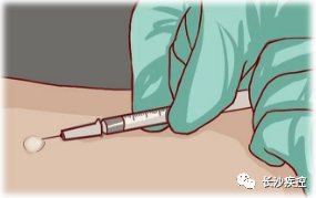 ppd|开学在即!当新冠疫苗接种遇上结核菌素试验 ,该怎么办?