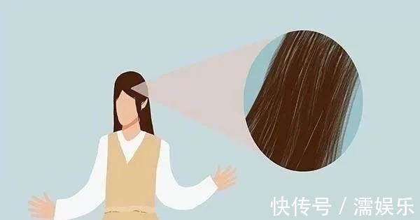 黑色素|告诉大家:为啥白头发会越长越多?医生:你以为是老了,其实是缺了两种营养