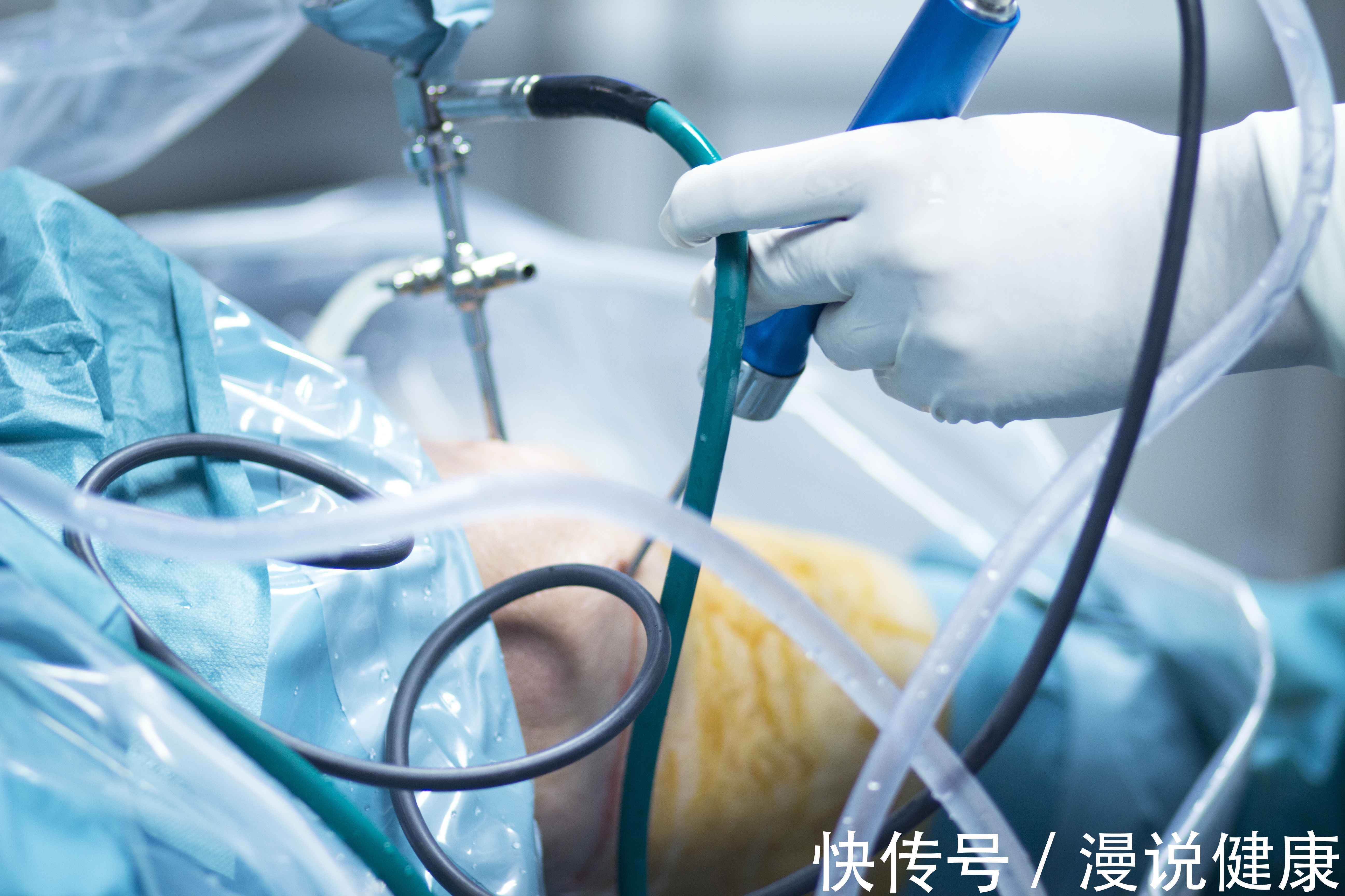 括约肌松弛|为何手术前,往往需要较长一段时间禁食呢?这个规定,医生告诉你