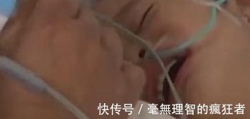 婴儿|2岁小孩说肚子痛,妈妈带去检查,竟然发现小孩怀孕肚子有一婴儿