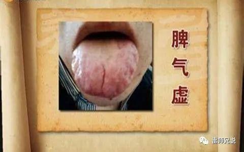 中药|人虚生百病,气虚、肺虚、脾虚,4味中药补虚不上火,身体更健康