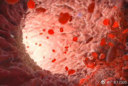 下肢|久坐对血液循环系统造成伤害!