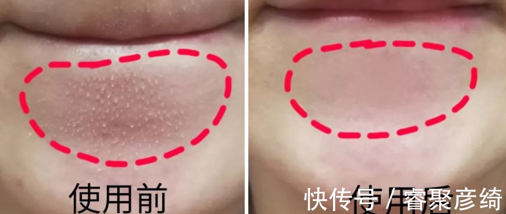 洗脸|为什么我的爽肤水不好用？