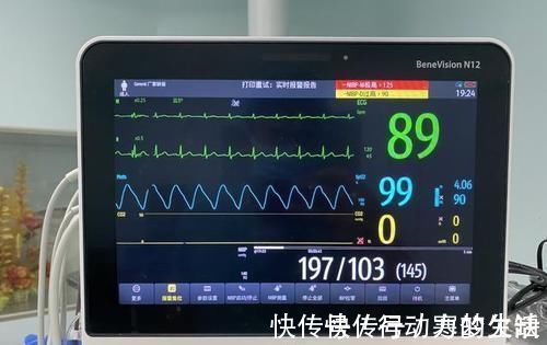 家庭|高血压,你会使用电子血压计吗?你知道家庭自测血压的要点吗?