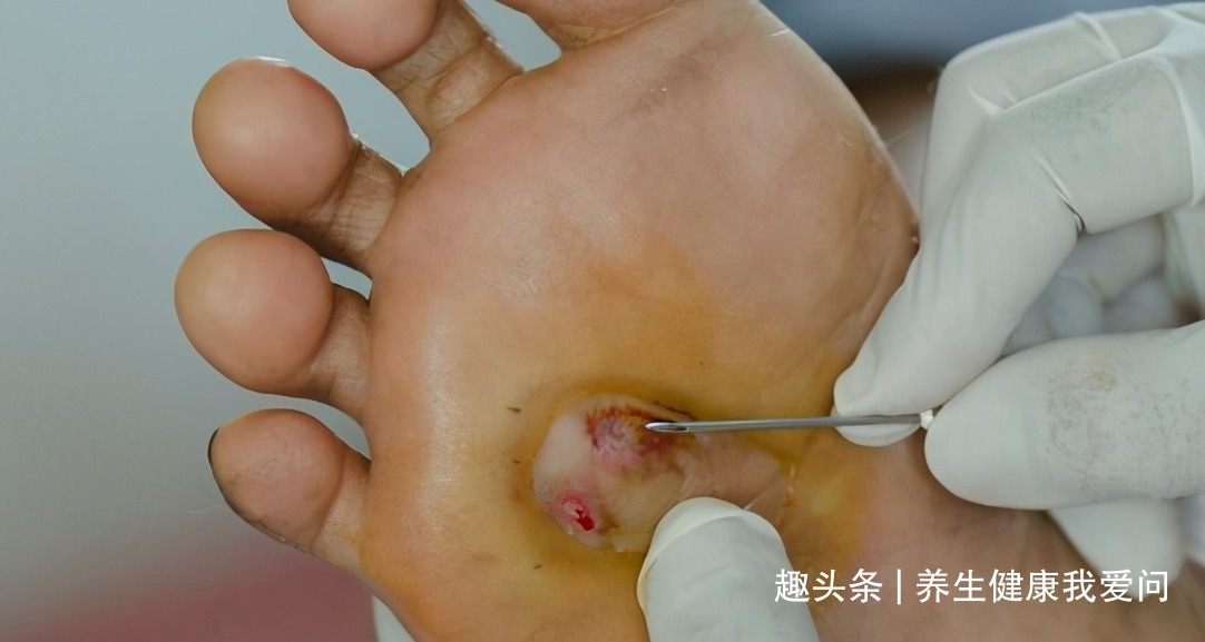 腰围|血糖过高，睡觉先知提醒睡觉有这2个表现，提示糖尿病已到来