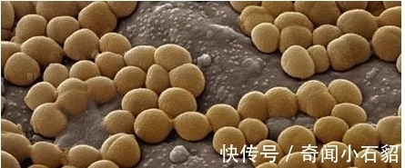 小孩|8岁小孩出去玩,回家不洗手按了个手印,妈妈培养48小时后