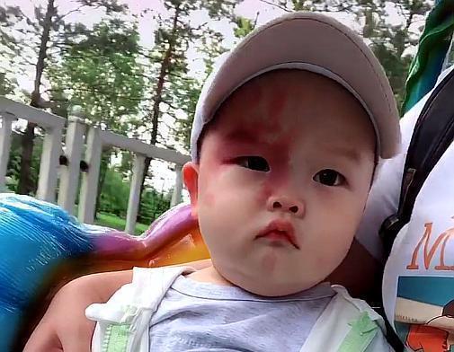 化妆品|孕期这三个行为,容易让胎记找上宝宝,准妈妈需尽量避开