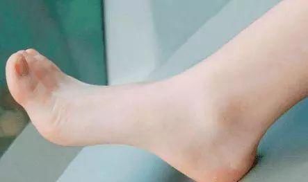 白糖倒在食用油中,解决了家家户户的困扰,学会受用一生