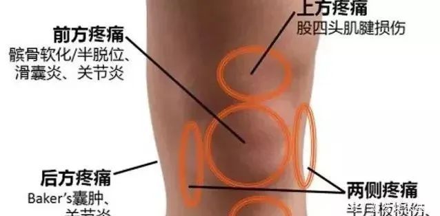 膝盖|奶奶膝盖疼下楼难,乡下70岁阿妈给了一秘方,7天膝关节炎消了!