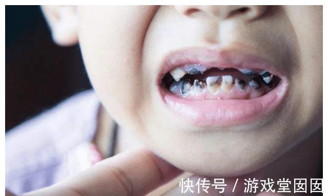 水杯|过了这个时间不给宝宝戒奶瓶,会导致娃龋齿,甚至影响颜值