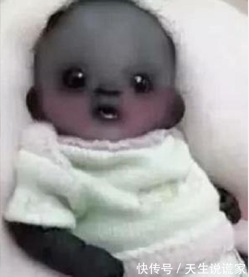 肤色|当年被定为“世界最黑的宝宝”,如今五年过去了,还这么黑吗?