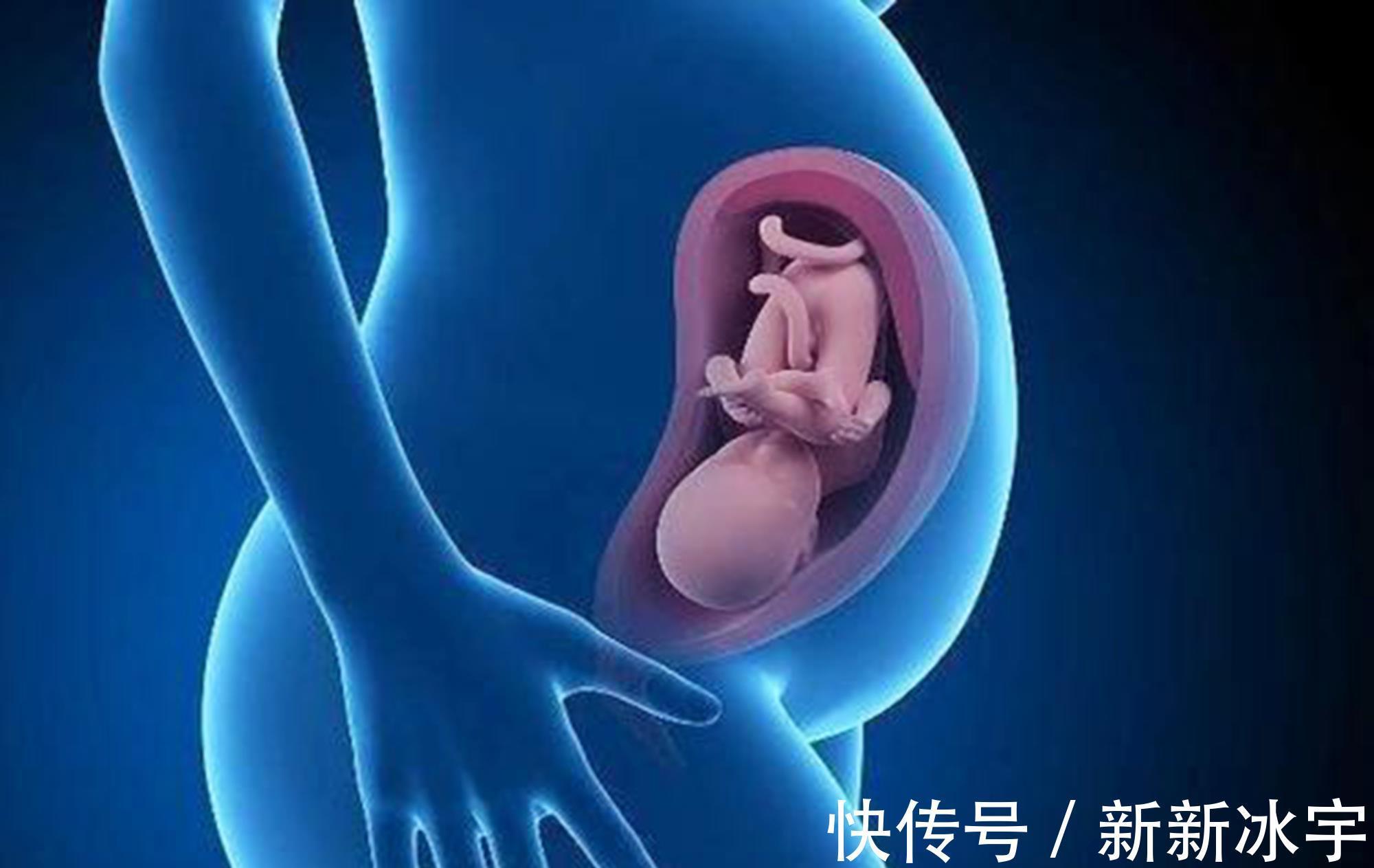 分娩|水中分娩好处颇多,为啥女明星很少用呢?产科专家:钱再多也没招