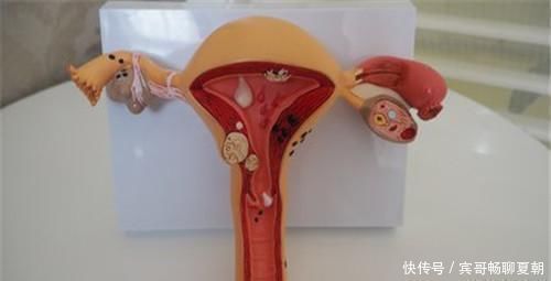 女人|绝经会让女人突然变老?要想皮肤光滑、衰老慢,首先要保养这里