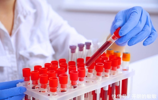 3项指标可预测肾病结局,全部都稳定,不怕尿毒症