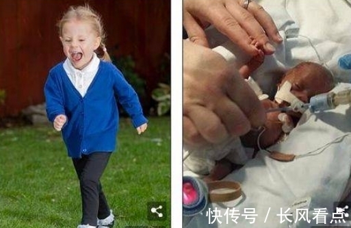 茉莉|生命斗士!出生体重不到1斤,手能穿过戒指,英迷你婴儿长大了!