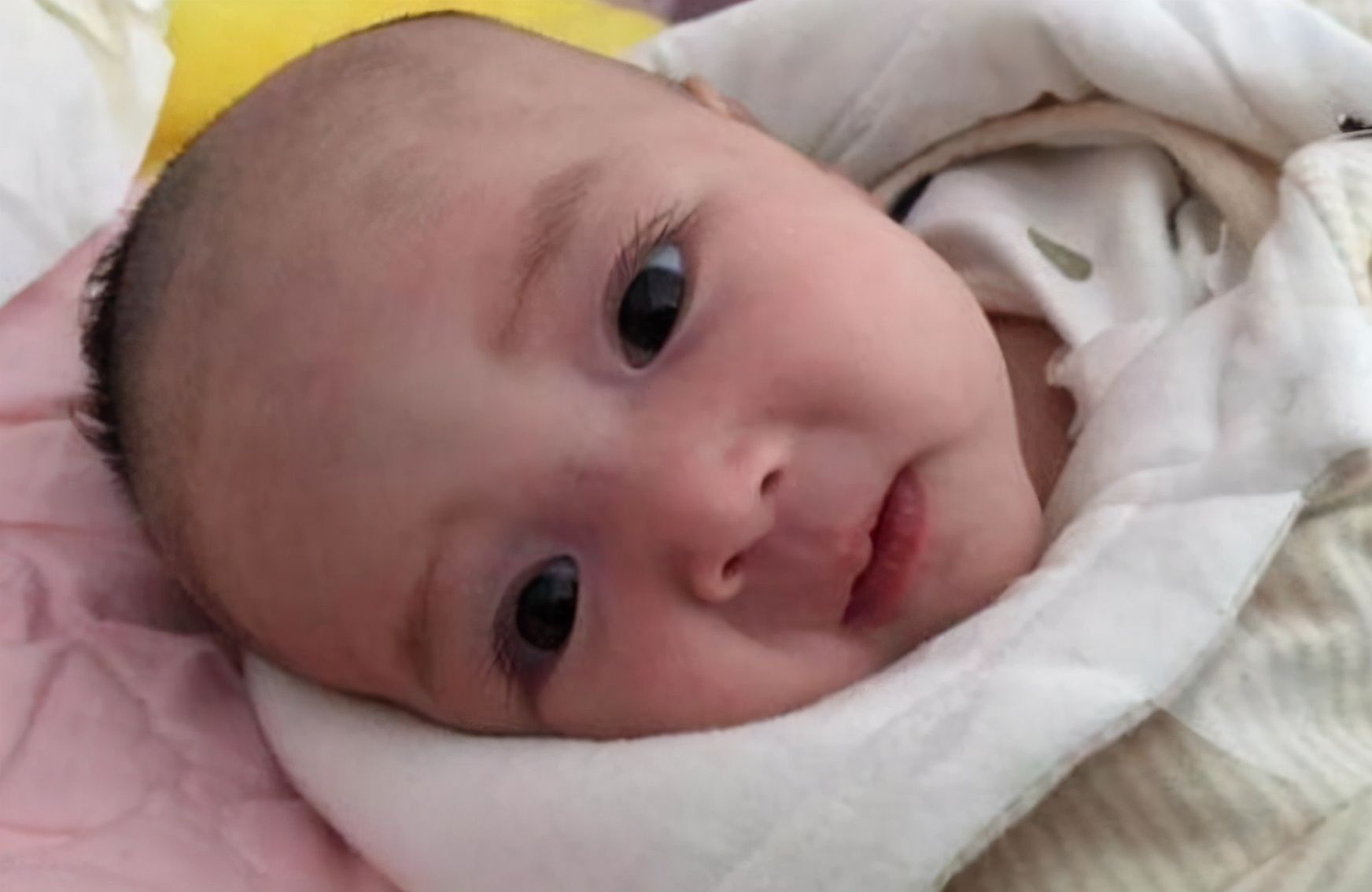 宝宝|宝宝“小脑袋瓜”不能随便摸，会影响孩子智力？囟门真那么脆弱？