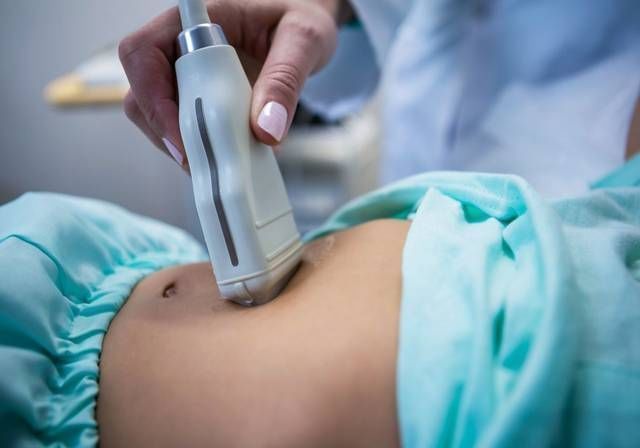 小婉|剖腹产有三种后遗症,生娃后难发觉,怀二胎时才显露,希望你没中