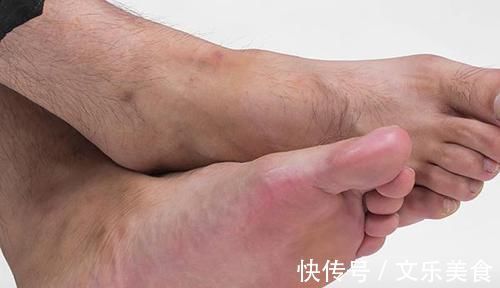 睡眠质量|经常泡脚有益身体健康，但若不避开“雷区”，泡多或也没用