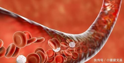 血管“堵塞”不用慌，多吃5种食物，疏通血管，和血栓说拜拜