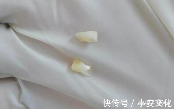 干细胞|孩子乳牙掉了先别扔,关键时候能救命事情可能没你想的那么简单