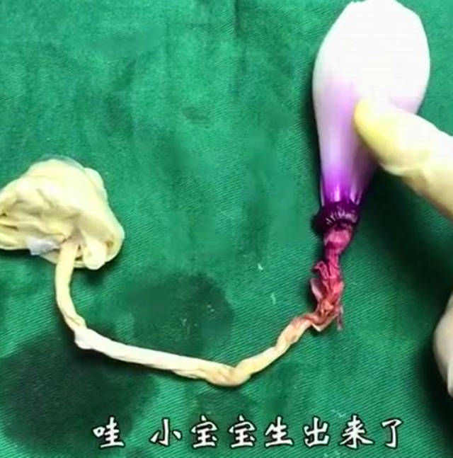 麻药|剖腹产仅是“蚂蚁蜇一下”看完这个洋葱,才明白受罪才刚开始