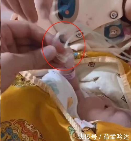 剪指甲|“暴躁新生儿”火了,抓着医生不松手,你给我剪的脐带吗?