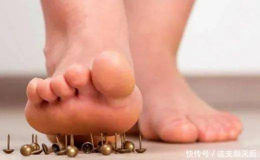 手部麻木的7种常见病因、如何鉴别及治疗