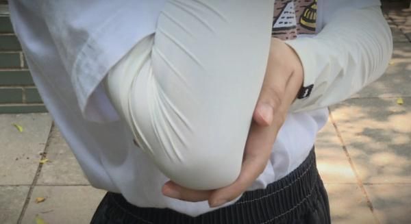 感染|五旬阿姨关节痛几个月，罪魁祸首竟是一碗汤！