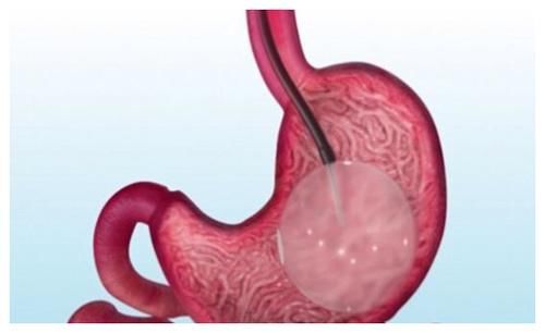 好处|洋葱好处多多，但尽量不要和它们一起炒，或许会对身体有影响