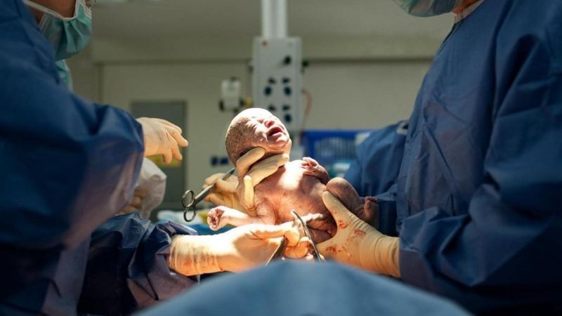 妈妈|顺产明明是最高级别的痛,为何妈妈都能撑过去?原来身体如此奇妙