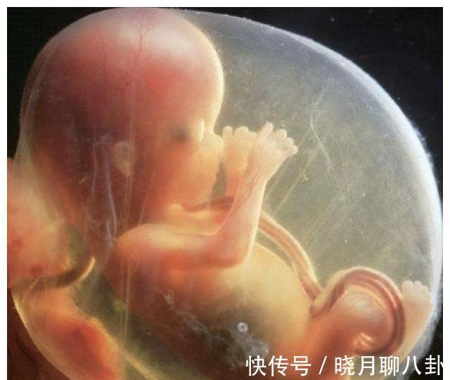 先天性心脏病|有多少孩子产检没问题,却出生后发现有问题?四种情况孕检查不出