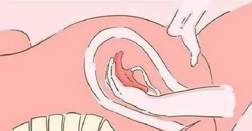 剖腹产|都说生孩子疼,其实产后这三件事比生孩子还要疼!你经历过几个?