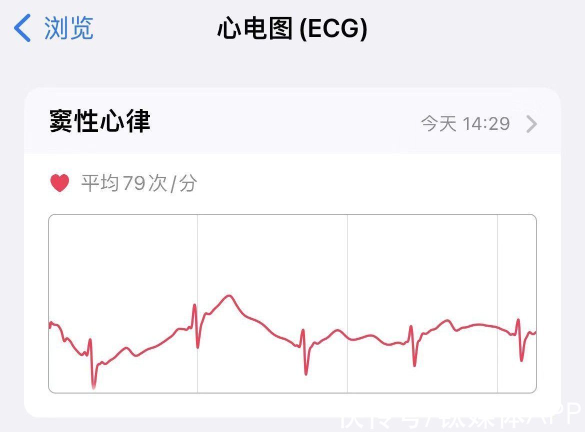 小雷|得到心电图功能后，Apple Watch要彻底统治中国市场？