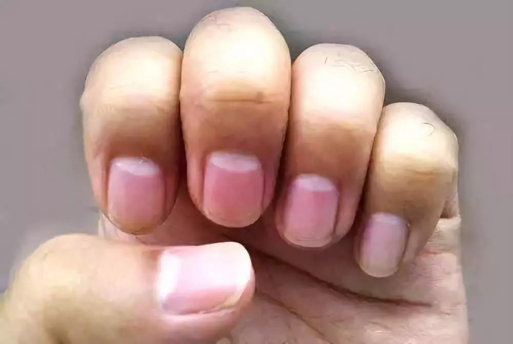 倪海厦|中医天才倪海厦:中医判断健康的十大标准(果断收藏)
