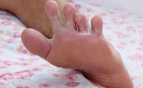 芡实|湿疹反反复复？“1敷、1喝”根治它，简单方便