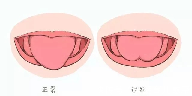 天使|天使锦囊:宝宝吐字不清、说话晚?这份口肌训练赶紧收藏吧